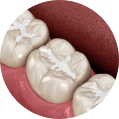 cavity icon